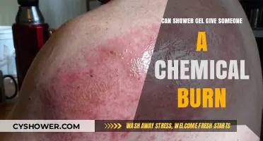 Shower Gel Chemical Burns: Causes, Symptoms, and Prevention Tips