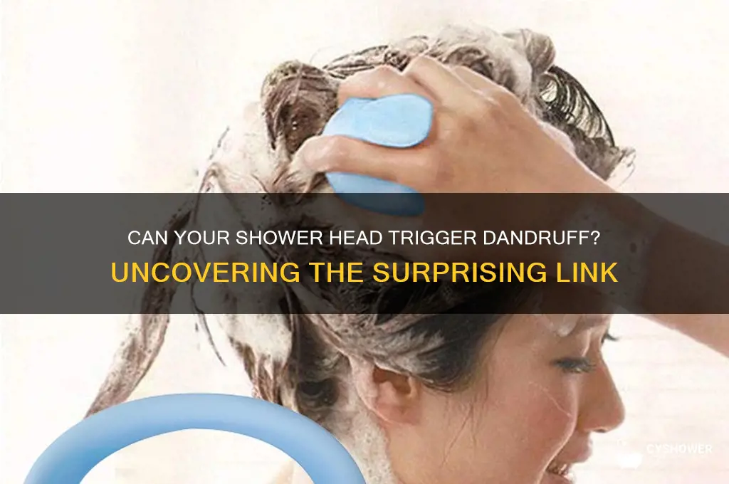 can shower head cause dandruff
