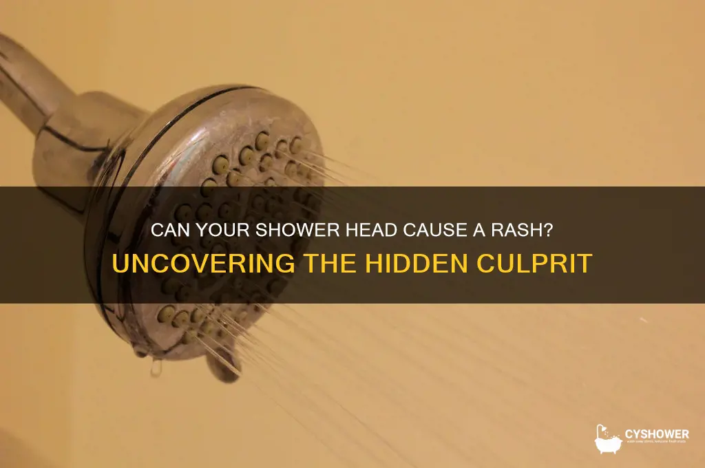 can shower head cause rash