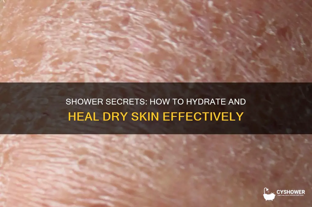 can shower help with dry skin