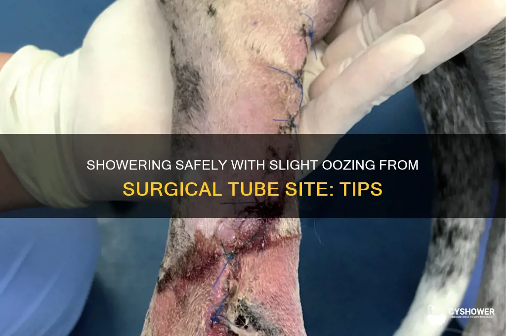 can shower if slight oozing from surgucal tube site