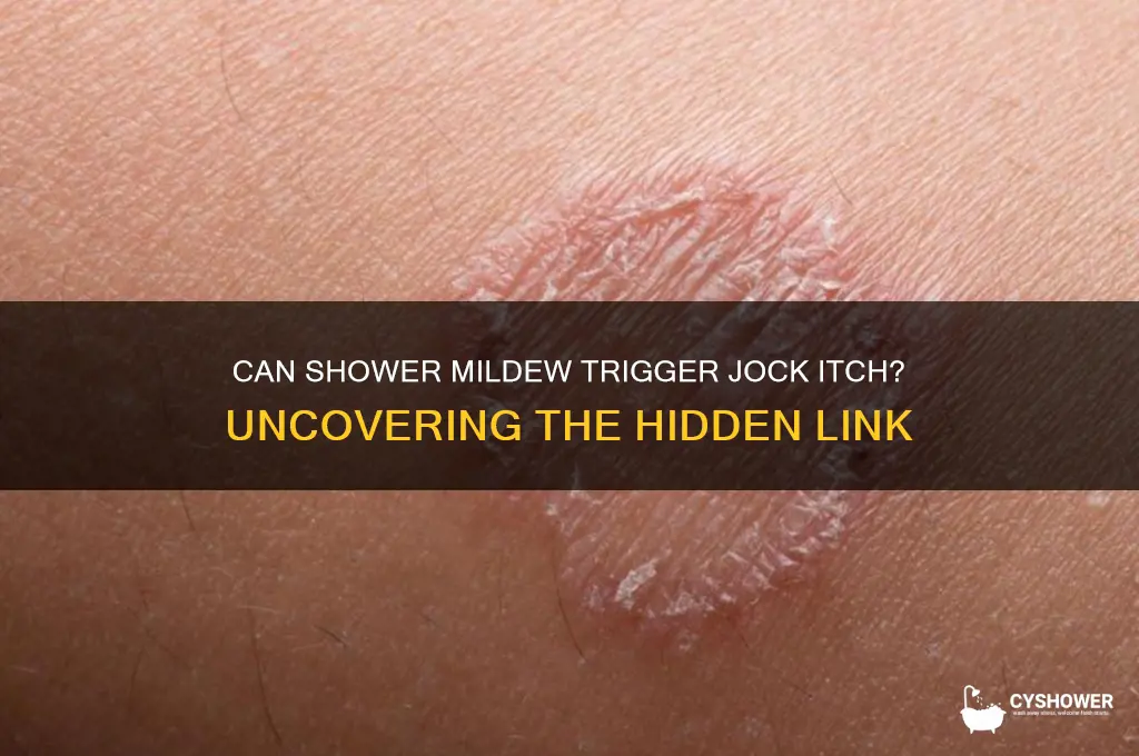 can shower mildew cause jock itch