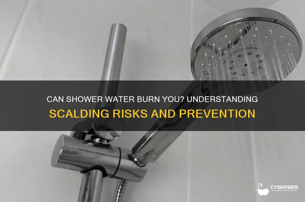 can shower water burn you