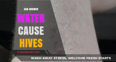 Can Shower Water Trigger Hives? Exploring the Surprising Connection