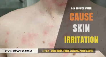 Shower Water and Skin Irritation: Causes, Prevention, and Solutions