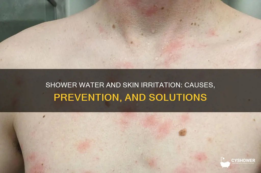 can shower water cause skin irritation