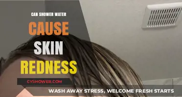Shower Water and Skin Redness: Causes, Prevention, and Solutions