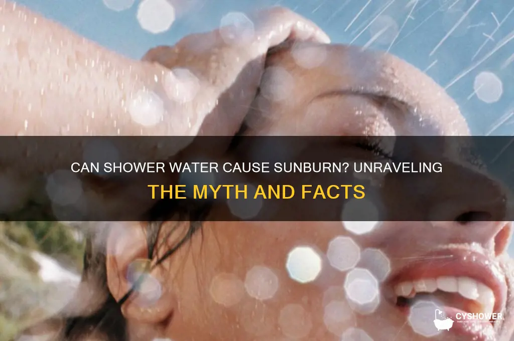 can shower water cause sunburn