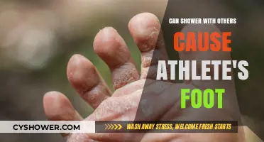 Sharing Showers: Can It Lead to Athlete's Foot?