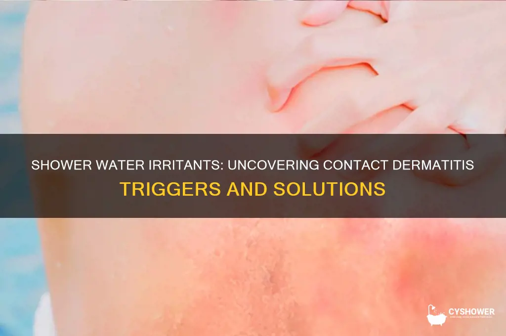 can something in shower water cause contact dermatitis