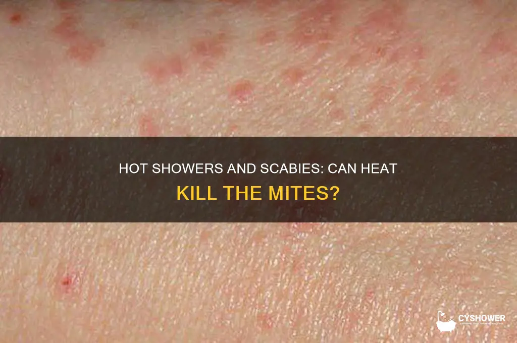 can taking a hot shower kill scabies