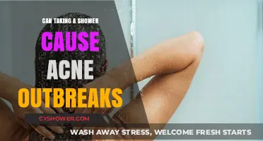 Showering and Skin: Unraveling the Link to Acne Outbreaks