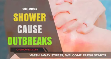 Showering and Skin Health: Unraveling the Outbreak Connection
