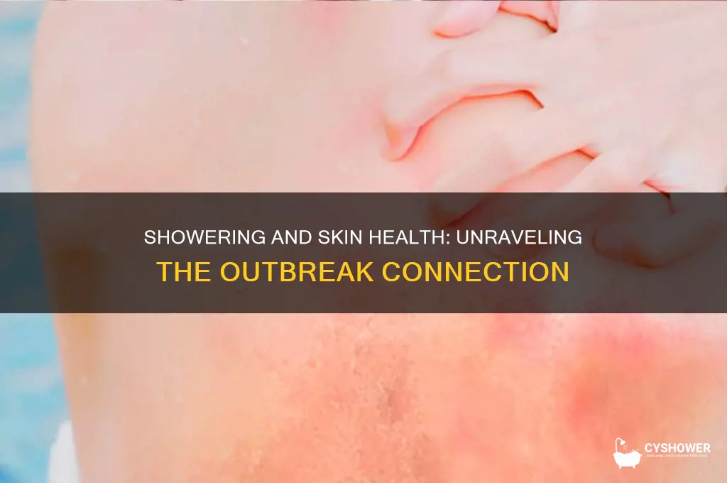 can taking a shower cause outbreaks