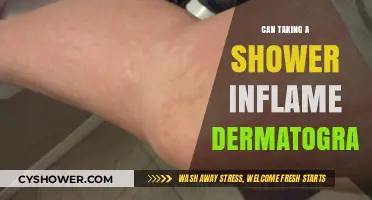 Showering and Skin Sensitivity: Can It Trigger Dermatographia Flare-Ups?
