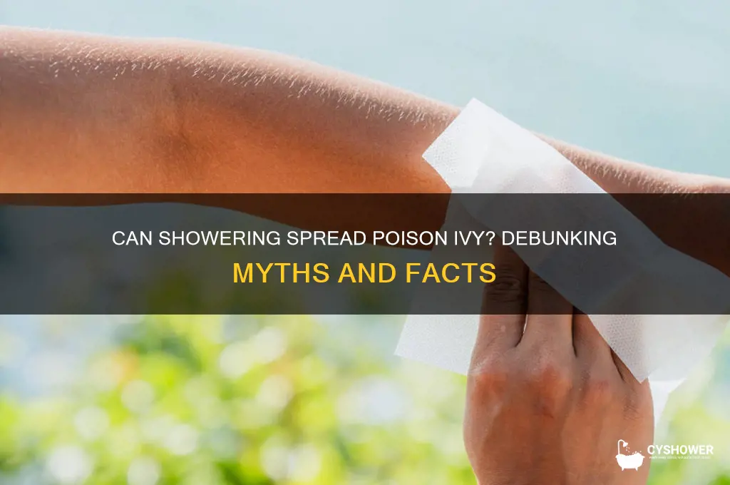 can taking a shower spread poison ivy