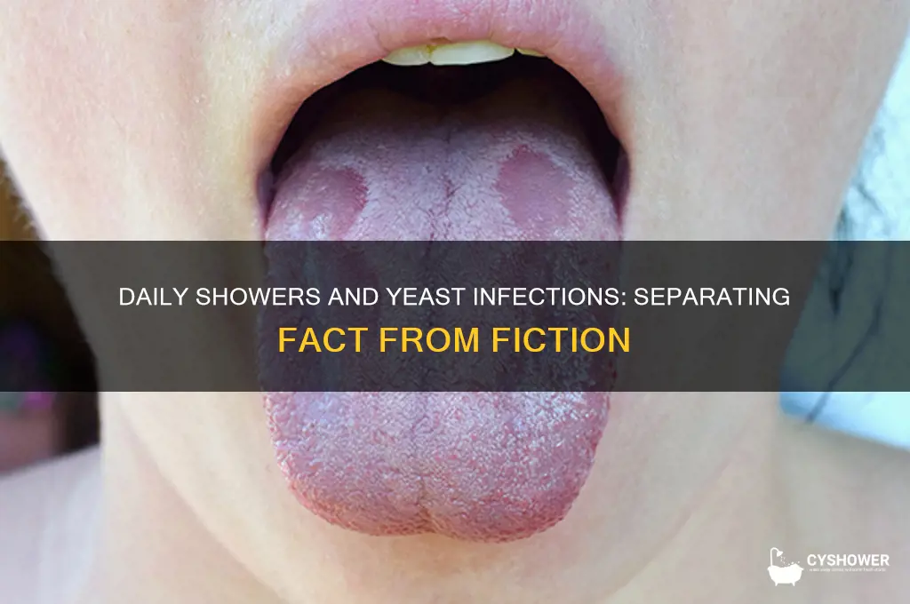 can taking daily shower give you a yeast infection