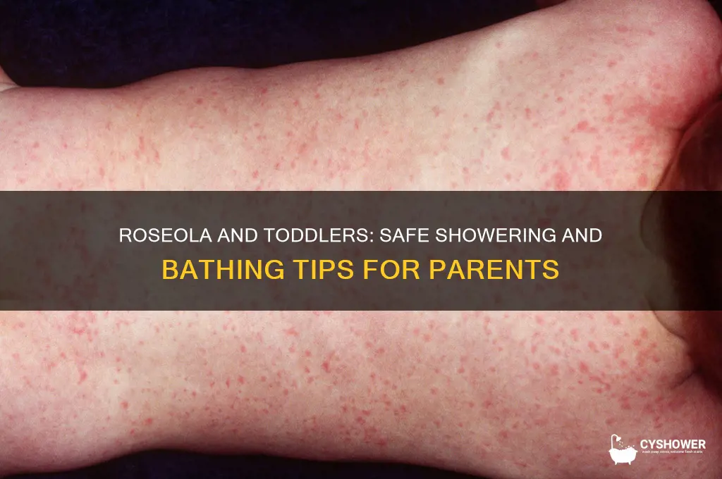 can toddlers shower and bath with roseola