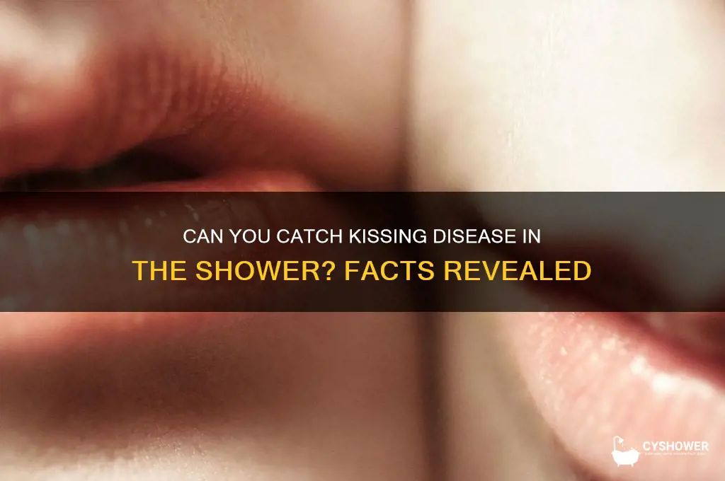 can u catch the kissung disease in shower