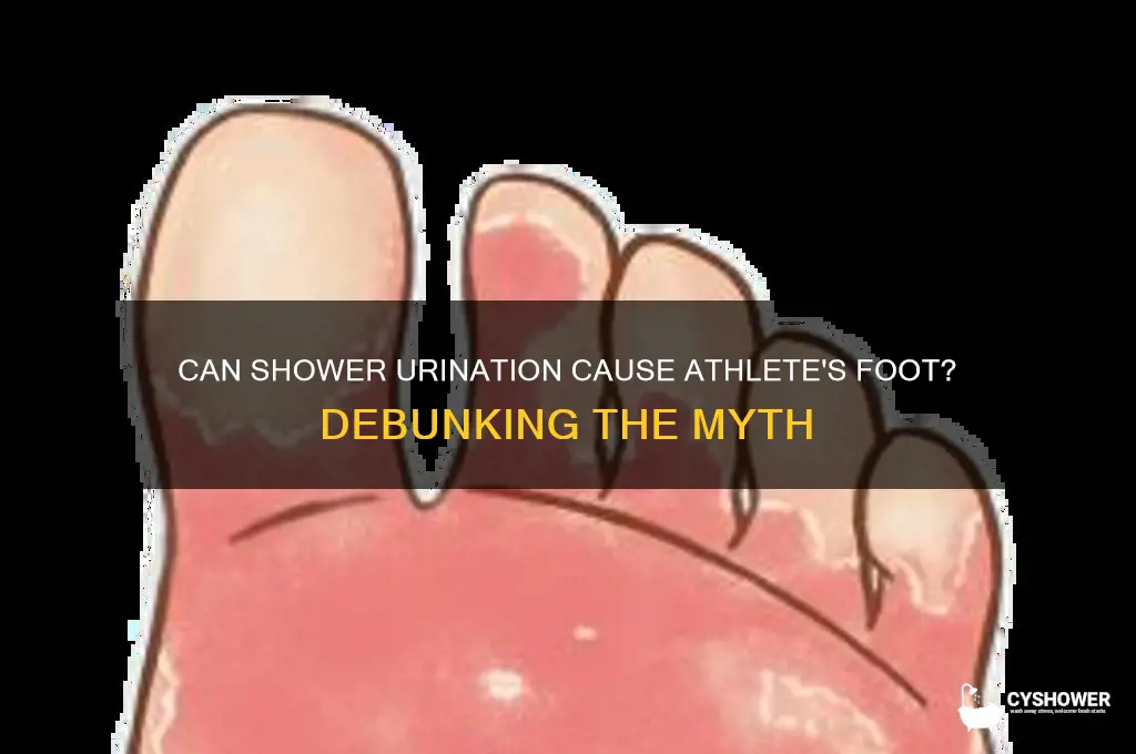 can u get athlete