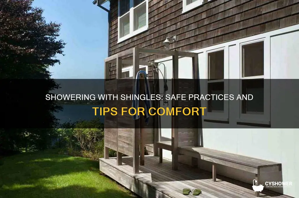 can u have a shower with shingles