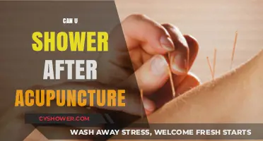 Showering After Acupuncture: What You Need to Know for Recovery
