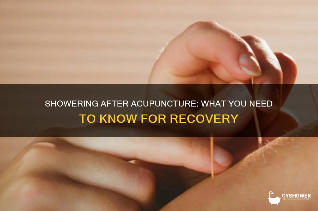 can u shower after acupuncture