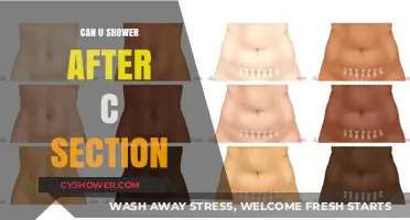 Post-C-Section Shower Guide: When and How to Safely Cleanse