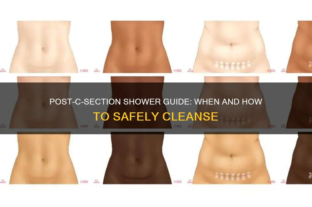 can u shower after c section