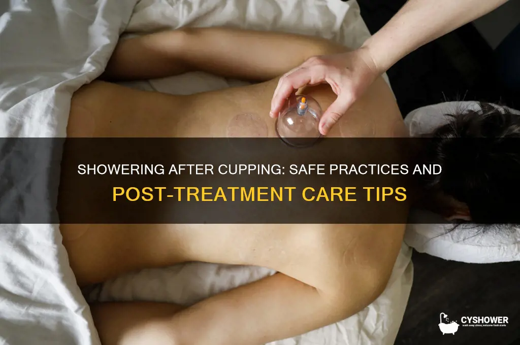 can u shower after cupping