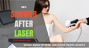 Showering After Laser Treatment: What You Need to Know