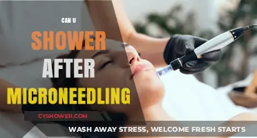 Microneedling Aftercare: When Can You Shower Safely?