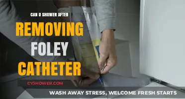 Showering Safely After Foley Catheter Removal: What You Need to Know