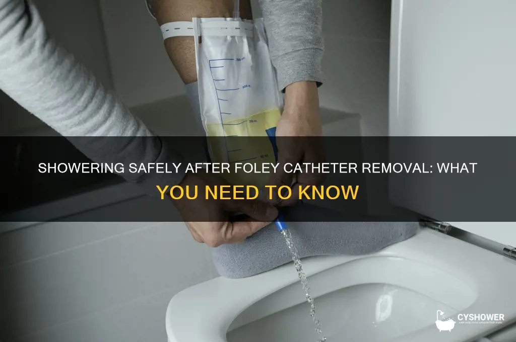 can u shower after removing foley catheter