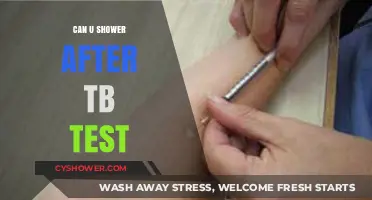 Showering After a TB Test: What You Need to Know