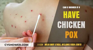 Showering with Chicken Pox: Safe Practices and Precautions to Follow