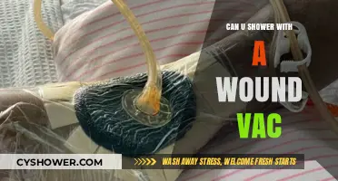 Showering with a Wound Vac: Tips, Safety, and Best Practices