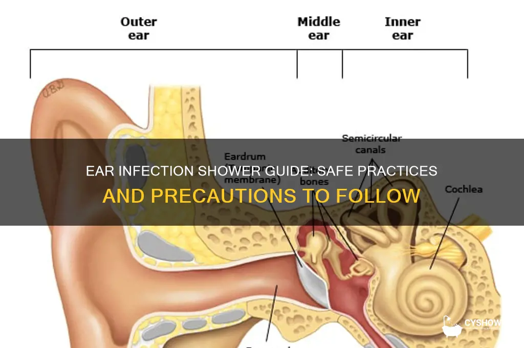 can u shower with an ear infection