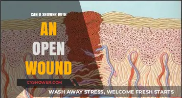 Showering with an Open Wound: Safe Practices and Precautions