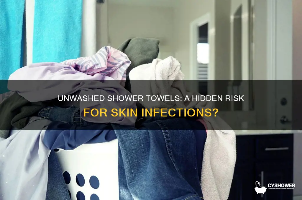 can unwashed shower towels cause infection