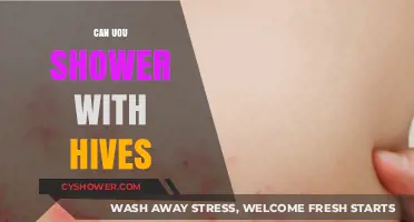 Showering with Hives: Safe Practices and What You Need to Know