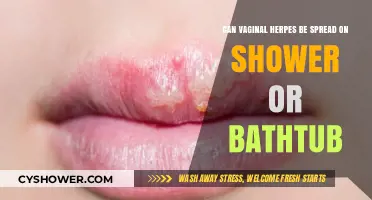 Can Vaginal Herpes Spread in Showers or Bathtubs? Facts Revealed