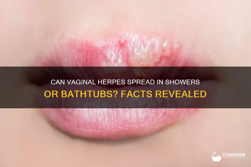 can vaginal herpes be spread on shower or bathtub