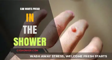 Can Warts Spread in the Shower? Facts and Prevention Tips