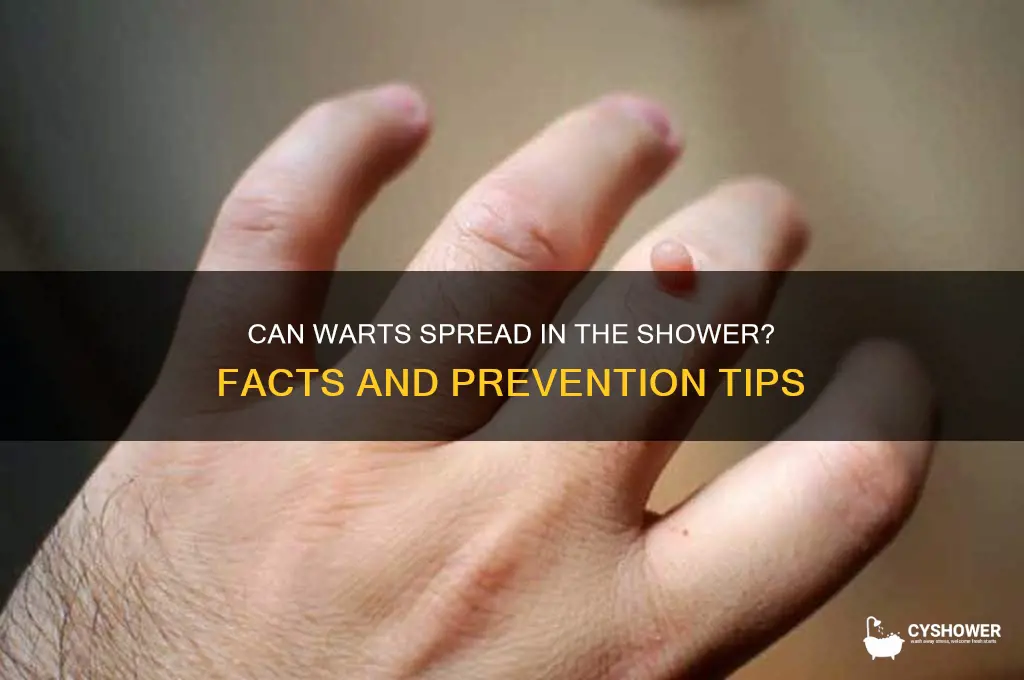 can warts pread in the shower