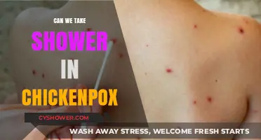 Showering with Chickenpox: Safe Practices and What to Avoid