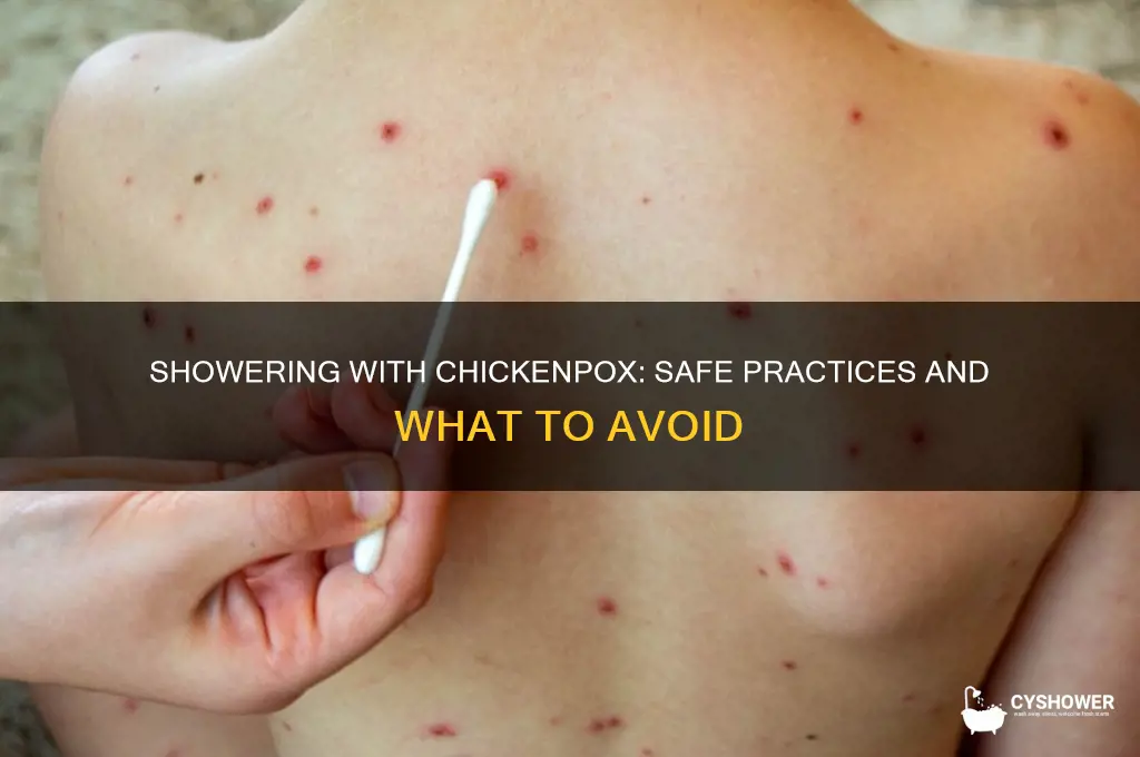 can we take shower in chickenpox