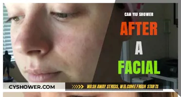 Showering After a Facial: Safe Practices for Healthy Skin