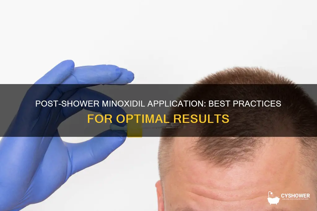 can you apply minoxidil after shower