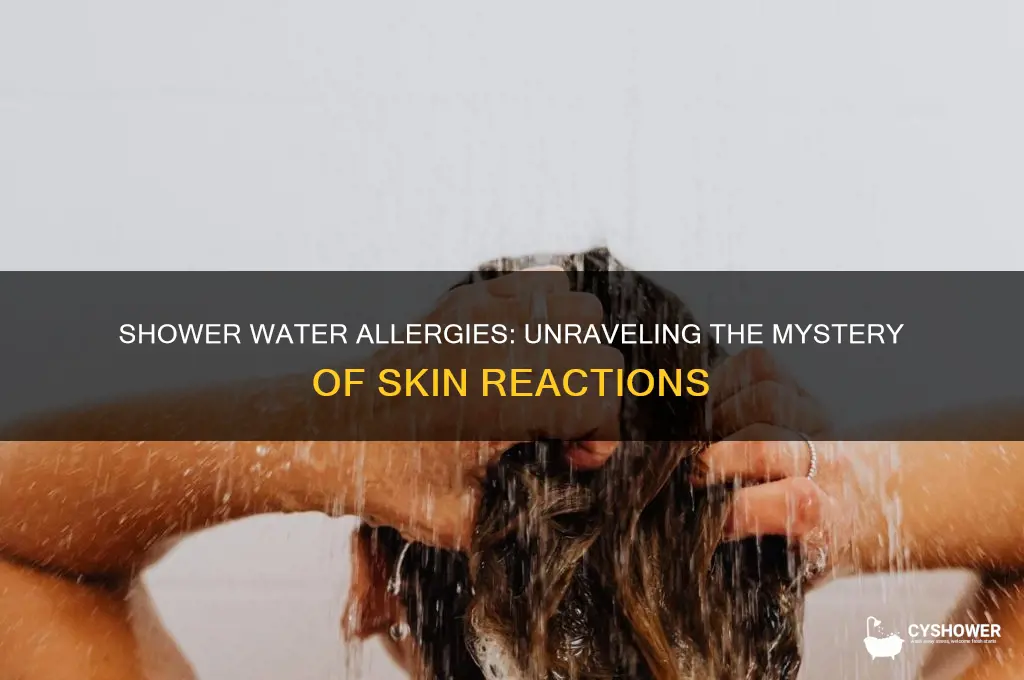 can you be allergic to shower water